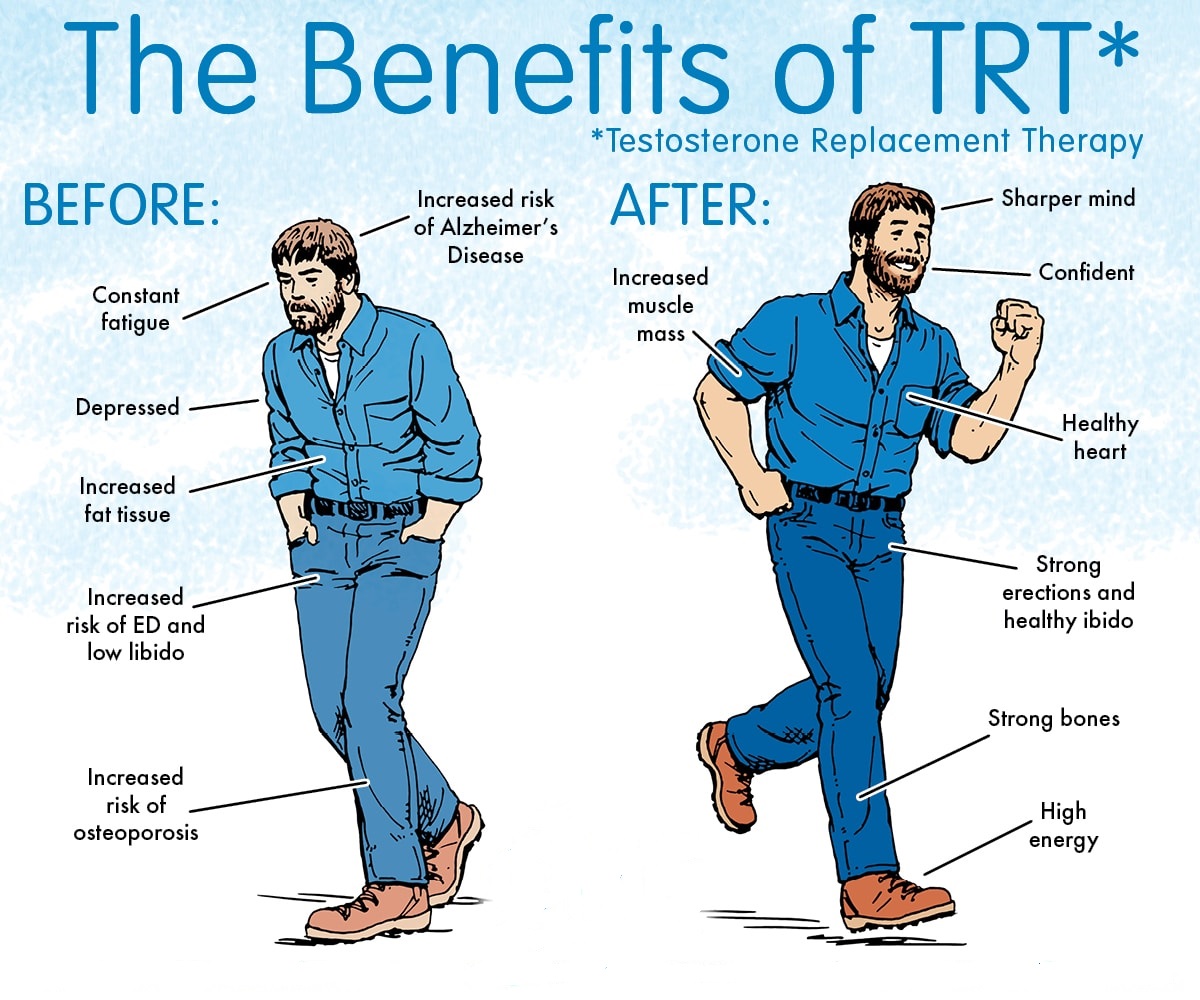 TRT – Testosterone Replacement Therapy